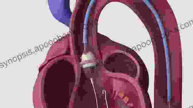 Cardiologist Using Microscope Transcatheter Aortic Valve Replacement: A How To Guide For Cardiologists And Cardiac Surgeons