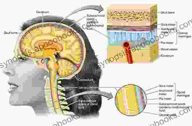 Detailed Diagram Of The Skull And Meninges Microneurosurgery Volume IVA: CNS Tumors: Surgical Anatomy Neuropathology Neuroradiology Neurophysiology Clinical Considerations Operability Treatment Options