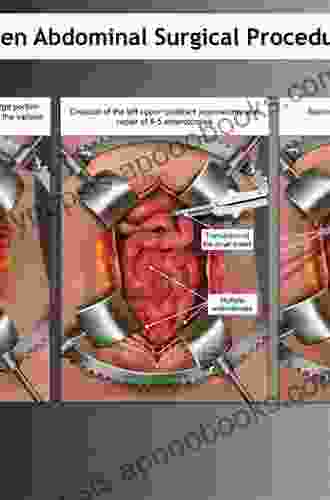 Colon And Rectal Surgery: Abdominal Operations (Master Techniques In Surgery)