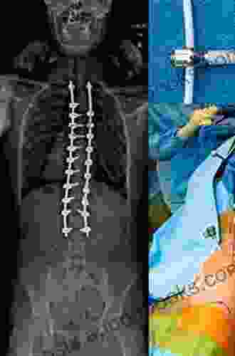 Surgery of the Pediatric Spine